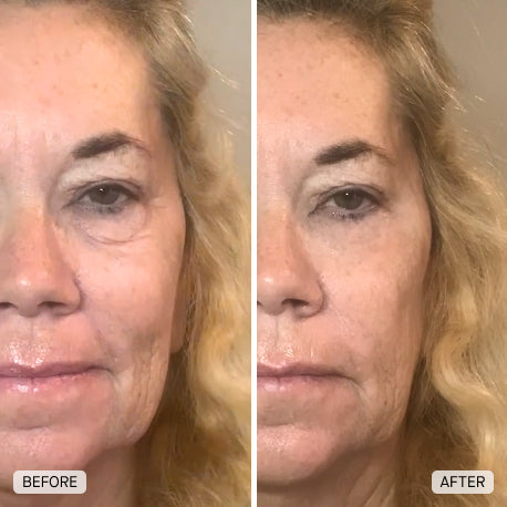 Visible skin results
